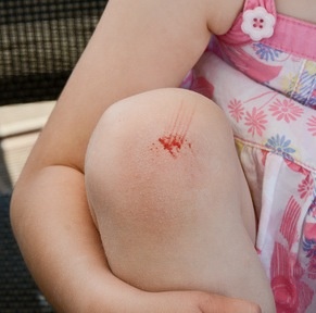 Gelenkverletzung beim Kind: Weniger ist mehr