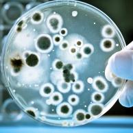 Bakterienkultur und Mikropsie