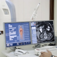 CT des Herzens (Kardio-CT)