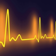 Elektrophysiologische Untersuchung am Herzen (EPU)