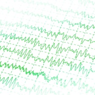 Elektromyografie (EMG)