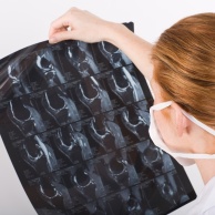 Röntgenuntersuchung der Galle und der Bauchspeicheldrüse (ERCP)