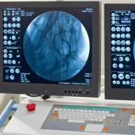 Röntgenuntersuchung der Gefäße (Angiographie, CT-Angiographie, MR-Angiographie, DSA)