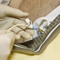 PEG (Perkutane endoskopische Gastroskopie)