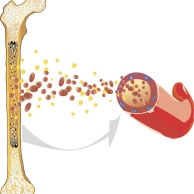 Transplantation - Knochenmark und Stammzellen