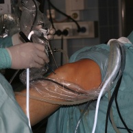 Gelenkspiegelung (Arthroskopie)