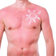 Aktinische (solare) Keratose