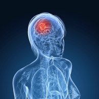 Akustikusneurinom (Kleinhirnbrückenwinkeltumor)