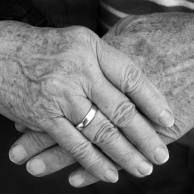 Altersflecken und Sonnenflecken