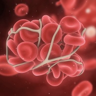 APC-Resistenz (Faktor-V-Leiden)