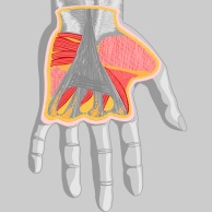 Beugesehnenverletzung an der Hand