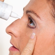 Bindehautentzündung