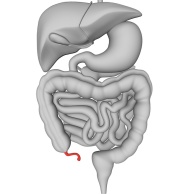 Blinddarmentzündung