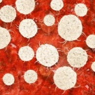 Chronische myeloische Leukämie (CML)